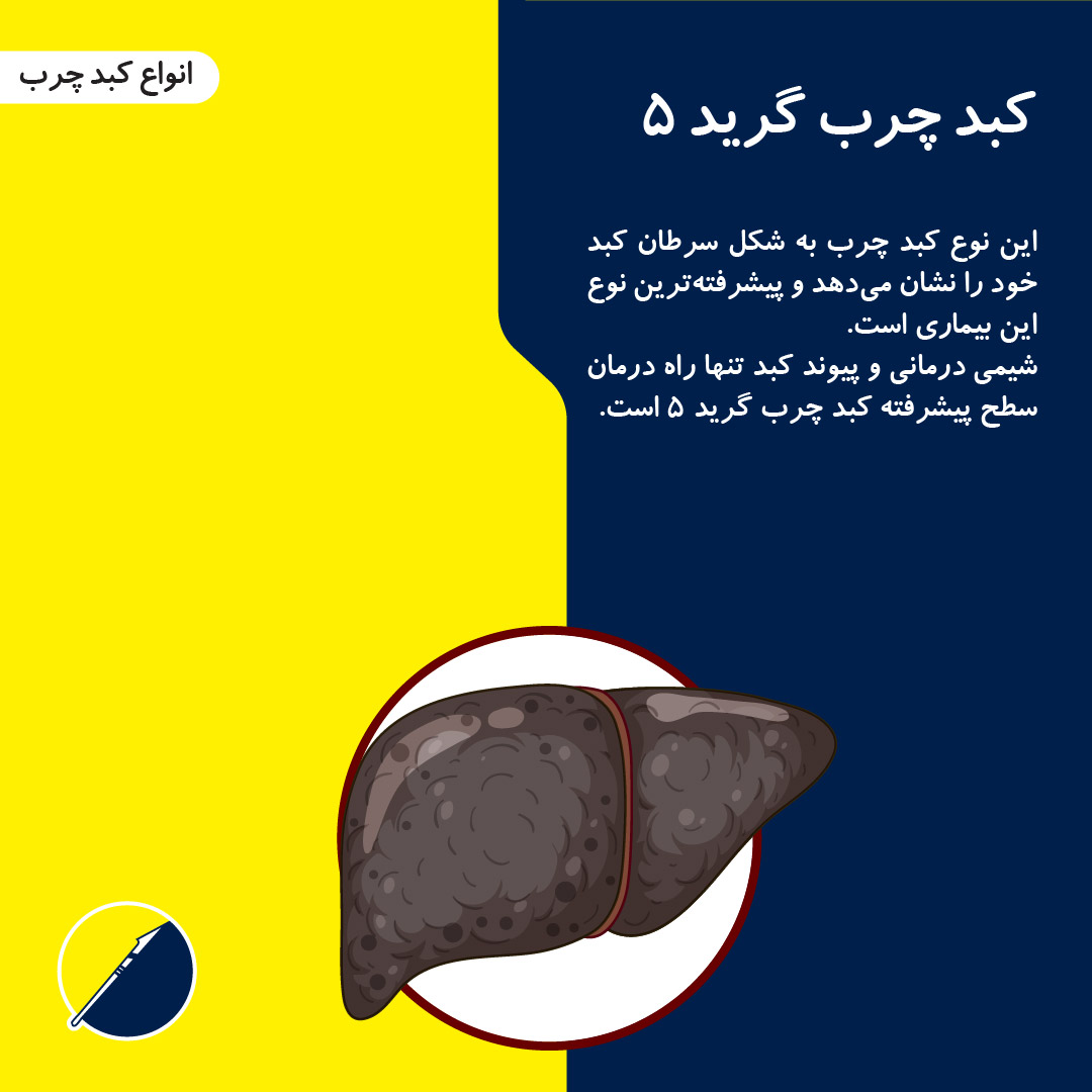 التعريف بأنواع الكبد الدهني